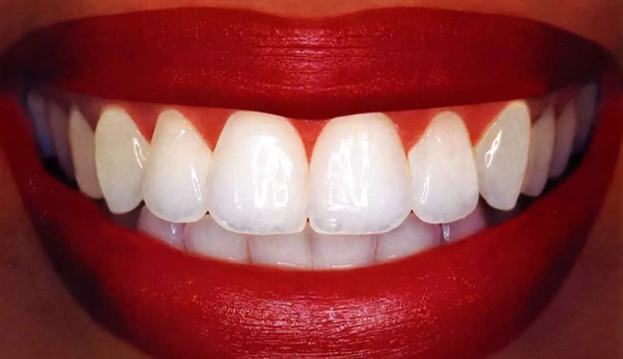 सफेद दांत