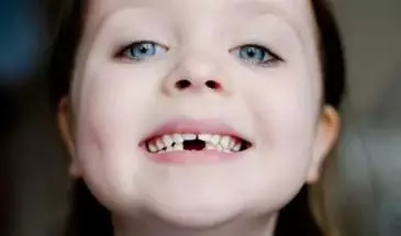 Meisje zonder tanden