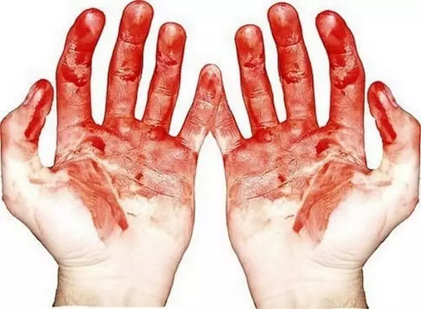 Händer i blod
