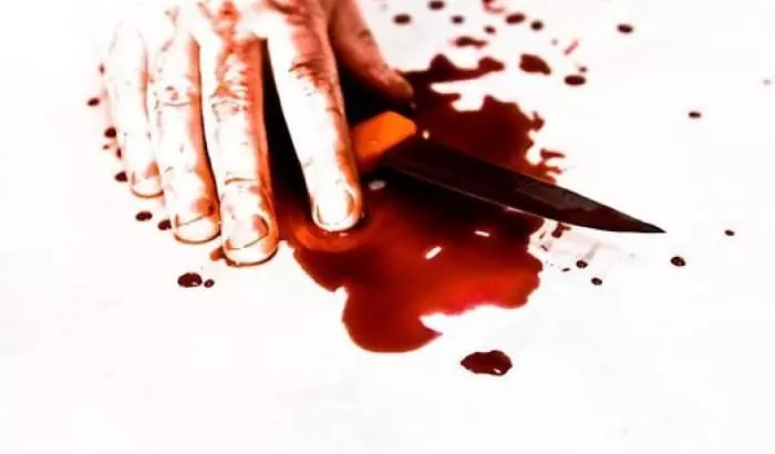 나이프와 피