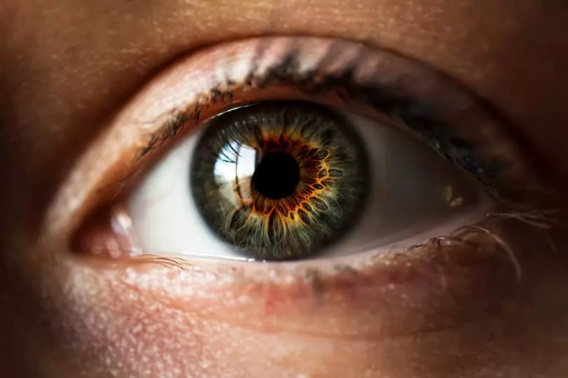 eye disease - unwillingness to see something