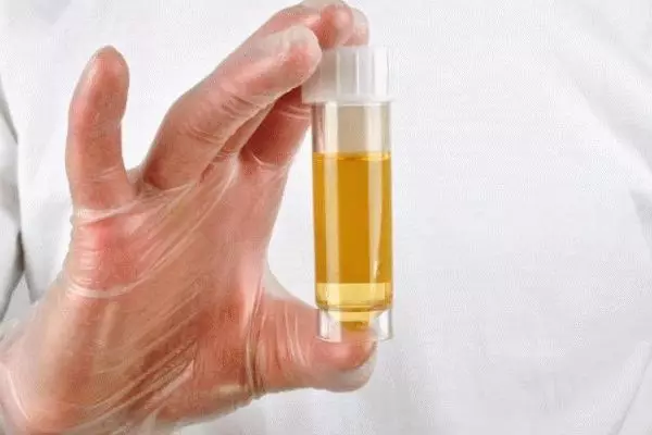 Testare con urina durante la gravidanza