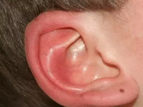 注：耳は何ですか？ 7704_3